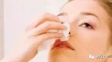 成人止鼻血棉球怎么用视频,成人操作指南-第2张图片-成年电影网 成人止鼻血棉球怎么用视频,成人操作指南-第2张图片-成年电影网